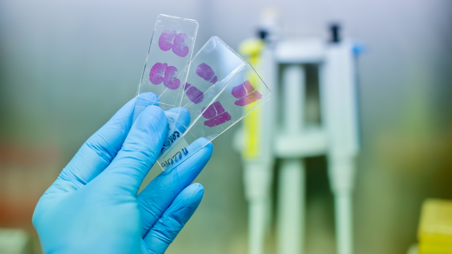 Main dans un gant de latex bleu tenant des échantillons histologiques